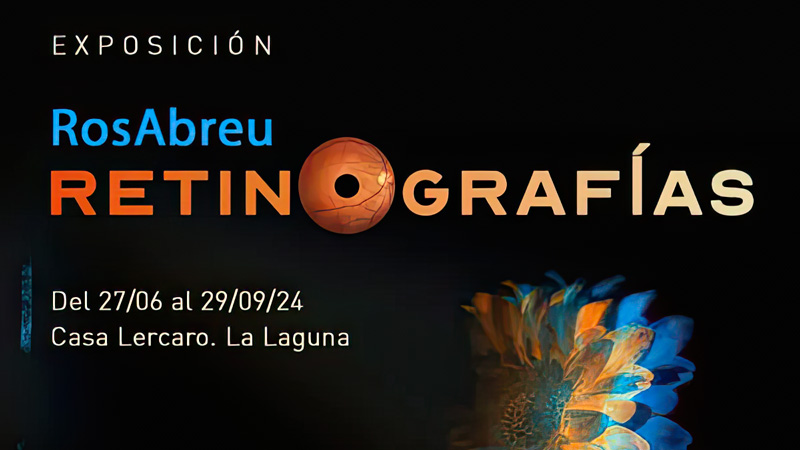 Retinografías – Exposición temporal